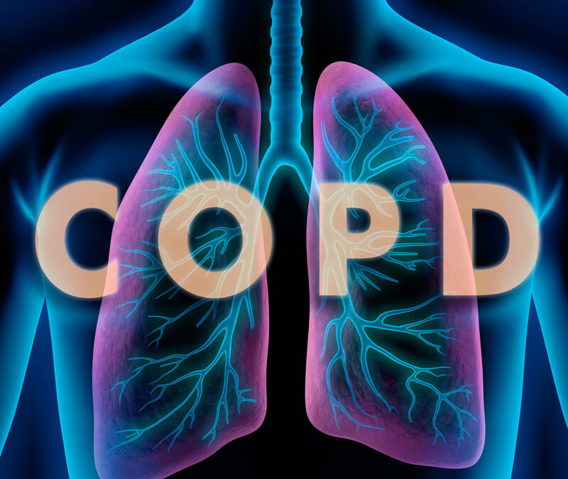 Fysiotherapeutische zorg bij COPD